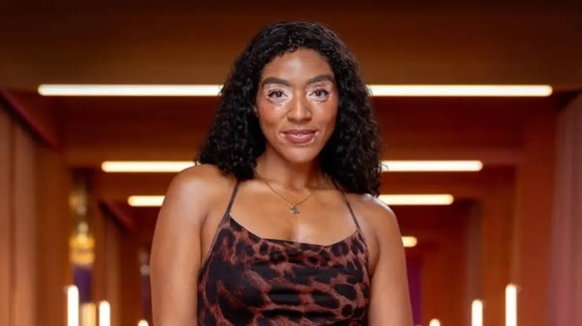 Yasmin Toseafa Bio: Age, Job, Vitiligo, Career  & Love Is Blind UK