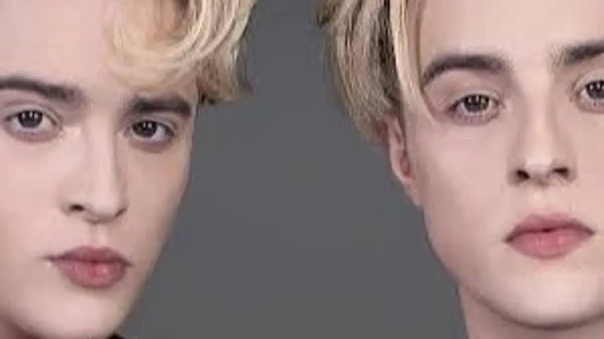 Jedward Bio: Age, Real Names, Career, Eurovision, Music and Life